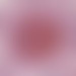 Polyarteriitis nodosa, systemische. Weiterer Detailausschnitt: Mittelkalibrige Arterie mit frisch...