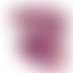 Rheumatic nodules. sharply defined "palisade granuloma" located in the deep dermis and in the adj...
