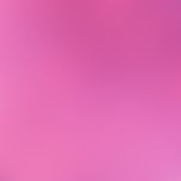 Detail: Irregularly configured zones with homogeneous, eosinophilic degeneration of collagenous c...