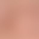 Collagenosis, reactive perforating. 12-month-old female patient: Itchy papules with a central dep...