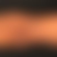 Kollagenose, reaktive perforierende. Gelenknahe, dissemnierte Anordnung&nbsp;der Läsionen.&nbsp;
