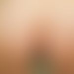 larva migrans. chronic dynamic disease, which appeared 3 weeks ago after a holiday in kenya. mult...