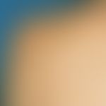 Lentigo solaris: Multiple, sharply defined light brown maculae in the area of the shoulders after...