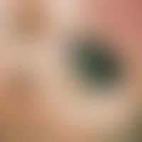 Lentigo maligna: multiple, chronically stationary, since more than 5 years existing, imperceptibl...
