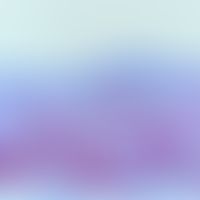Lentigo maligna: penetration of the epithelium with bizarrely configured melanocytes; immunohisto...