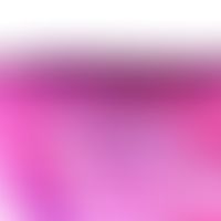 Lentigo solaris. irregular, button-like acanthosis with hyperpigmentation. orthokeratosis. pronou...