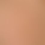 LEOPARD syndrome. detail enlargement: multiple, sharply defined, 0.2-0.8 cm large, brownish spots...