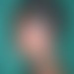 Leprareaktion vom Typ I "upgrading reaction": bei einer Patientin mit Boderline lepromatöser Lepr...
