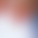 Leukonychie: In Querstreifen verlaufende Weißfärbungen der Nagelplatte bei einer 20-jährigen Frau...