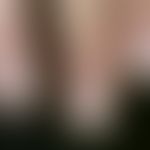 Leukonychie: Periodische, punkt- oder streifenförmige Weißfärbungen der Nagelplatte, die einen od...