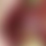 Leukoplakie, orale:&nbsp;55 Jahre alter Zigarettenraucher. Chronisch stationäre, einseitige, fläc...