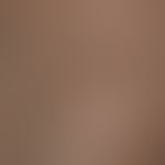Lichen nitidus in dark skin, generalized form, detailed view of the small non-aggregated, dissemi...