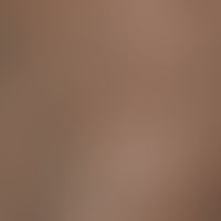 Lichen nitidus in dark skin, generalized form, detailed view of the small non-aggregated, dissemi...