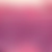 Lichen planus atrophicans. dense band-shaped lymphocytic infiltrate. distinct epidermotropy. vacu...