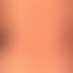 Lichen planus exanthematicus: for 3 months persistent, itchy, generalized, dense rash with emphas...