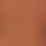 Lichen planus exanthematicus: for several months persistent, itchy, generalized, dense rash with ...