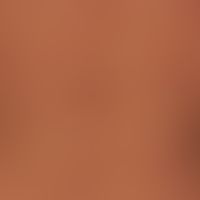 Lichen planus exanthematicus: for several months persistent, itchy, generalized, dense rash with ...