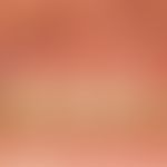 Lichen planus mucosae. veil-like, blurred, whitish, sometimes also reddish (right side) plaques o...