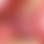Lichen planus. veil-like, whitish, blurred, symptomless plaques on the posterior mucosa of the ch...