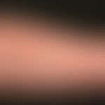 Lichtdermatose, polymorphe:s eit vielen Jahren rezidivierende, stark juckende, jeweils wenige Stu...