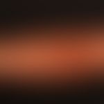 Lipomas: spherical soft painless tumours that have reached this size over a period of 3-4 years, ...
