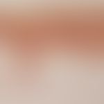 Livedo racemosa. Histology, overview magnification. Vascular occlusion in deep corium. Elastica v...
