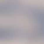 Melanom, malignes. Sentinel Lymphknoten. Lymphknoten mit immunhistologisch markierter Mikrofilia ...