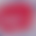 Melanom, malignes. Detailvergrößerung Sentinel Lymphknoten: Lymphknotenmetastase. Mikrofilia eine...