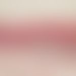 Melanom, malignes, akrolentiginöses. Intraepidermale und subepidermale Infiltration von Melanomze...
