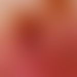 Melanom, malignes, amelanotisches. Auflichtmikroskopie. Weitgehend Melanin-freies Parenchym. Rand...