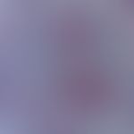 Melanom, malignes, desmoplastisches. Immunhistologie: S100-positive Zellhaufen in breit angelegte...