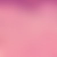 Melanom, malignes, desmoplastisches. Übersichtsvergrößerung: Diffuse Infiltration der oberen und ...