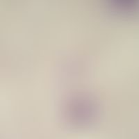 Sleeping sickness. trypanosoma brucei gambiense: blood form. mostly there are slender elongated f...