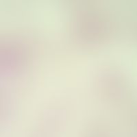 sleeping sickness. trypanosoma brucei gambiense: blood forms. the undulating membrane and the fla...