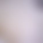 Sleeping sickness. Glossina wing. Typical for the glossines is the hatchet-shaped central cell in...