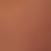 Scleromyxoedema: Multiple 0.1-0.2 cm large, roundish, non follicular papules with a smooth, shiny...