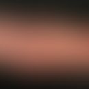 Survey of the left arm: Generalized skin atrophy with diffuse, livid redness, telangiectasia, and...