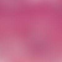 Still syndrome. detail enlargement: epithelium with orthokeratotic keratinization. the dermo-epid...
