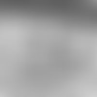 Stratum granulosum, electron microscopy, detail enlargement: Keratohyalingranulae (KH) below the ...