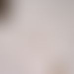 Strongyloidose:&nbsp;Rhabditiforme (filariforme) Larve von Strongyloides stercoralis. Nachweis au...
