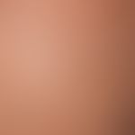 Stucco keratosis. disseminated, up to 0.4 cm large, white-grey, symptomless papules with wart-lik...