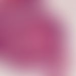 Syringocystadenoma papilliferum. Detailvergrößerung: Zylindrisches Drüsenepithel mit Dekapitation...
