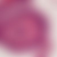 Detail enlargement: Cylindrical glandular epithelium with decapitation (see small droplets of sec...