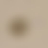 Taeniasis. egg of Taenia spp. (T. solium and saginata - eggs are not distinguishable). an egg cap...