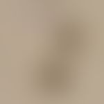Taeniasis: Two eggs of Taenia spp. with the typical thick, radial embryophores and the missing eg...