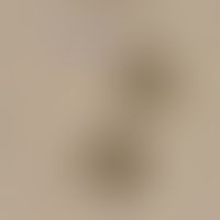 Taeniasis: Two eggs of Taenia spp. with the typical thick, radial embryophores and the missing eg...