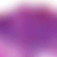 Talgdrüsenepitheliom (Sebazeom): unterschiedlich große, gut abgegrenzte basaloide Zellverbände mi...