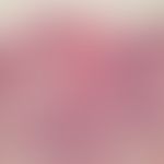 Sebaceous gland hyperplasia, senile. numerous mature sebaceous gland lobules around an ectatic, h...