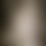Pityriasis amiantacea. solitary, chronically active plaque affecting the entire hairy area of the...