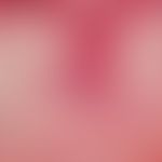 Lupus erythematodes chronicus discoides. Follikuläre Hyperkeratose. Histologisches Korrelat zum T...